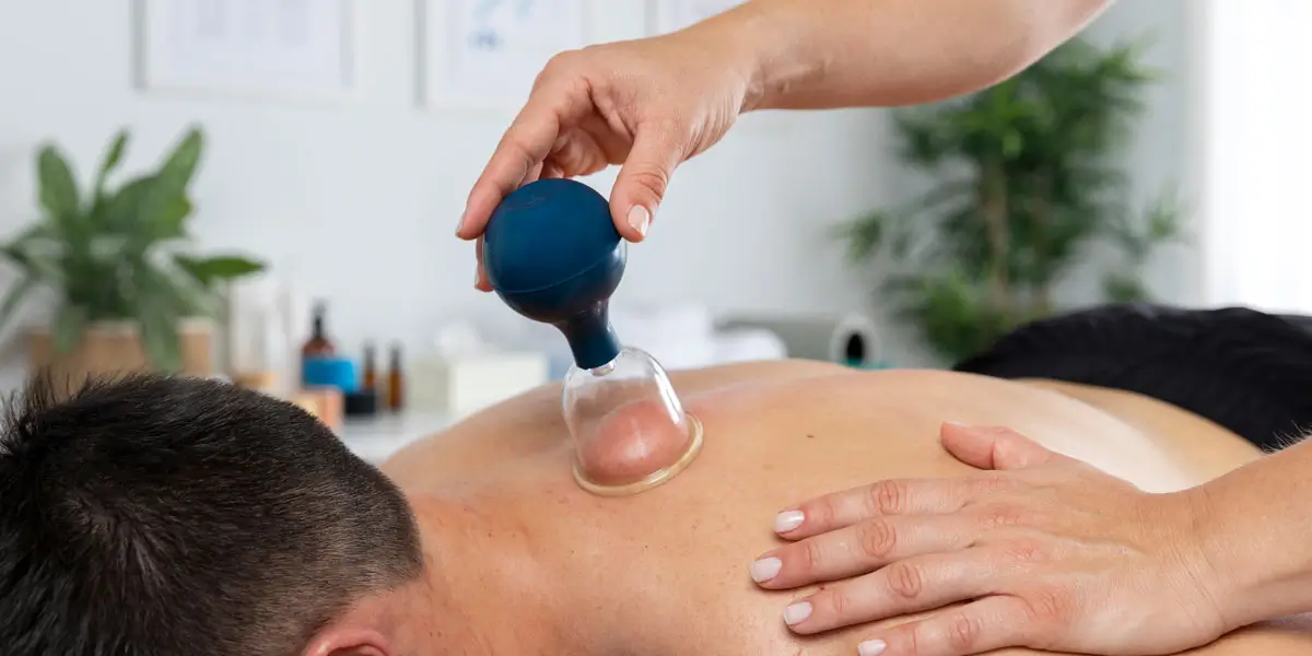 Schröpfbehandlung bei einem Mann: Eine Therapeutin setzt ein Schröpfglas mit Gummiball auf den oberen Rücken in einer modernen Praxisumgebung.